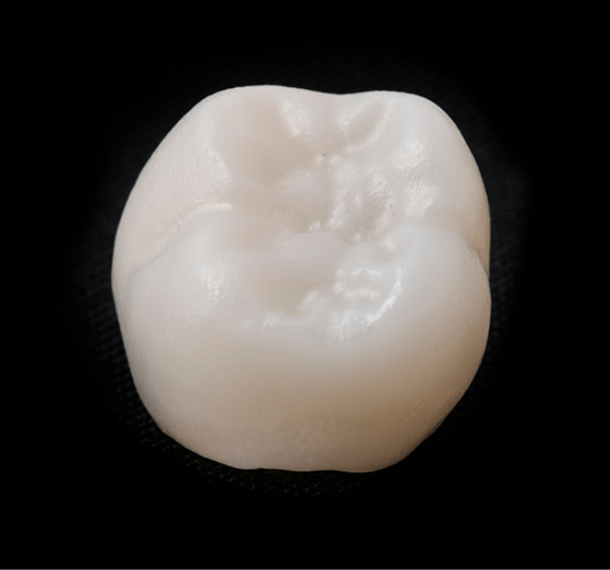 Close-up of dental crown on black background