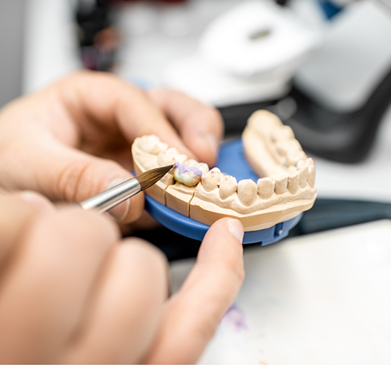 Technician working on dental crown attached to model of teeth