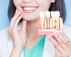 dentist holding a model of a dental implant in the jaw