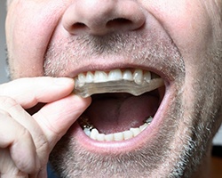 Man wearing a mouthguard 