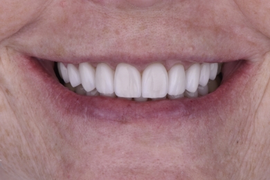 Smile after treatment