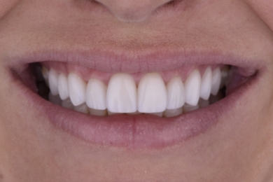 Smile after treatment