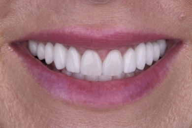 Smile after treatment