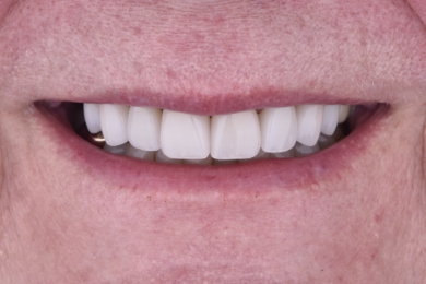 Smile after treatment
