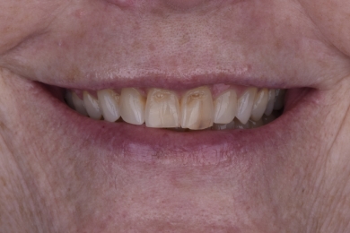 Smile before treatment