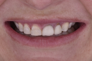 Smile before treatment