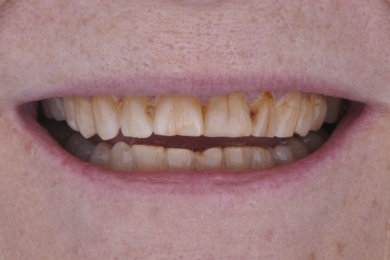Smile before treatment