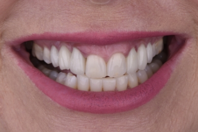 Smile before treatment