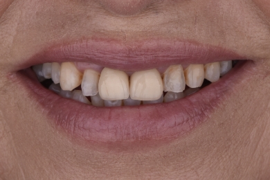 Smile before treatment