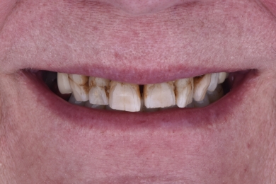 Smile before treatment