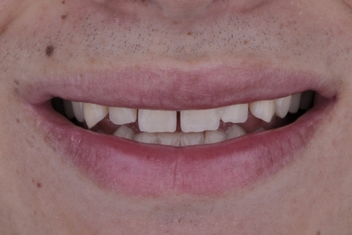 Smile before treatment