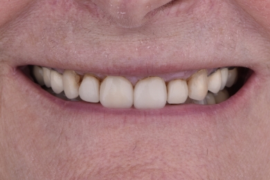 Smile before treatment