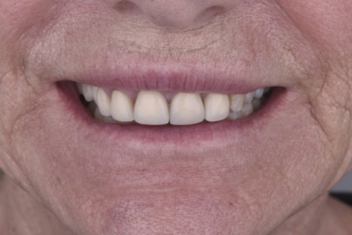Smile before treatment
