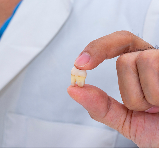 Close-up of hand holding tooth