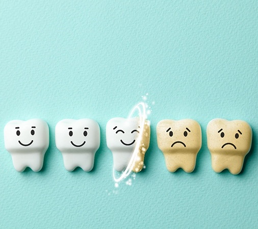 Illustration of teeth whitening in Midlothian